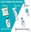 CeraVe Retinol Serum for Post-Acne Marks and Skin Texture | Pore Refining, Resurfacing, Brightening Facial Serum with Retinol and Niacinamide | Fragrance Free, Paraben Free & Non-Comedogenic| 1 Oz - Image 4